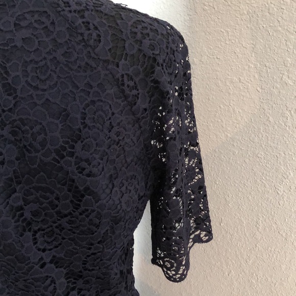 Madewell Lace Dress - Picture 6 of 8